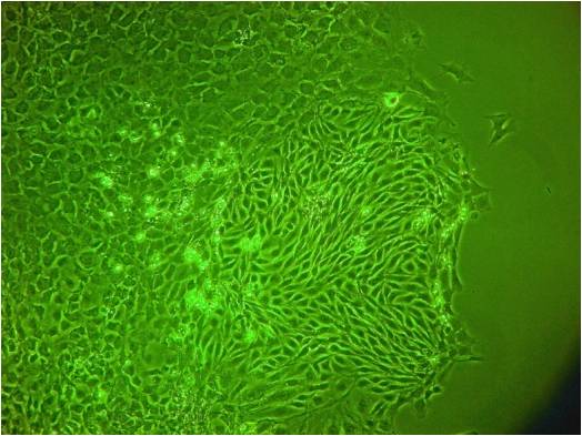 元気に増殖中の動物（マウス皮膚由来）細胞（光学顕微鏡像）
