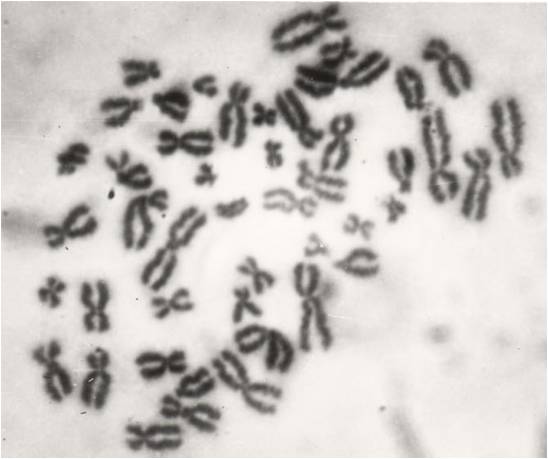ヒト細胞1個分の染色体（光学顕微鏡像）
